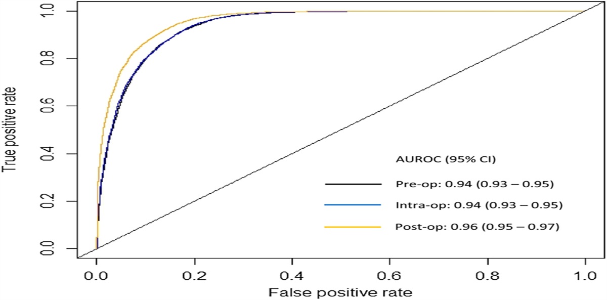 Using Machine Learning (XGBoost) to Predict Outcomes After Infrainguinal Bypass for Peripheral Artery Disease