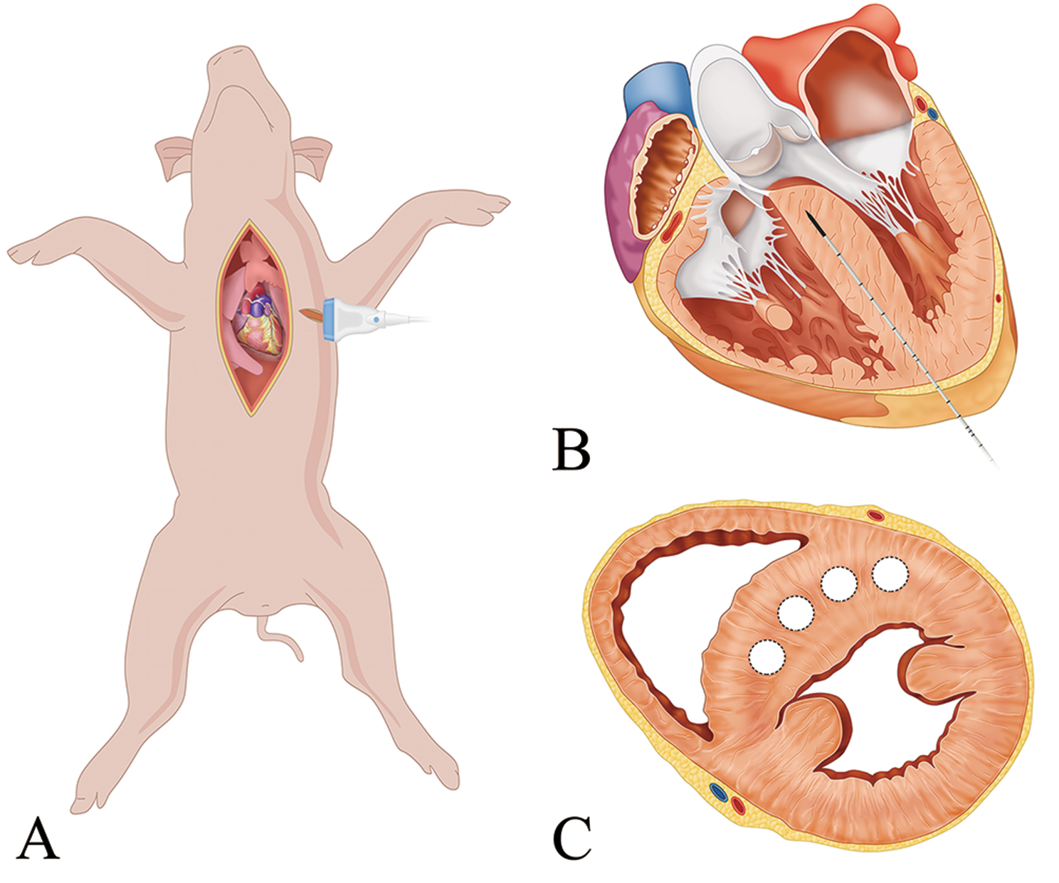 Transapical intramyocardial septal microwave ablation in treatment of hypertrophic obstructive cardiomyopathy: 12-month outcomes of a swine model