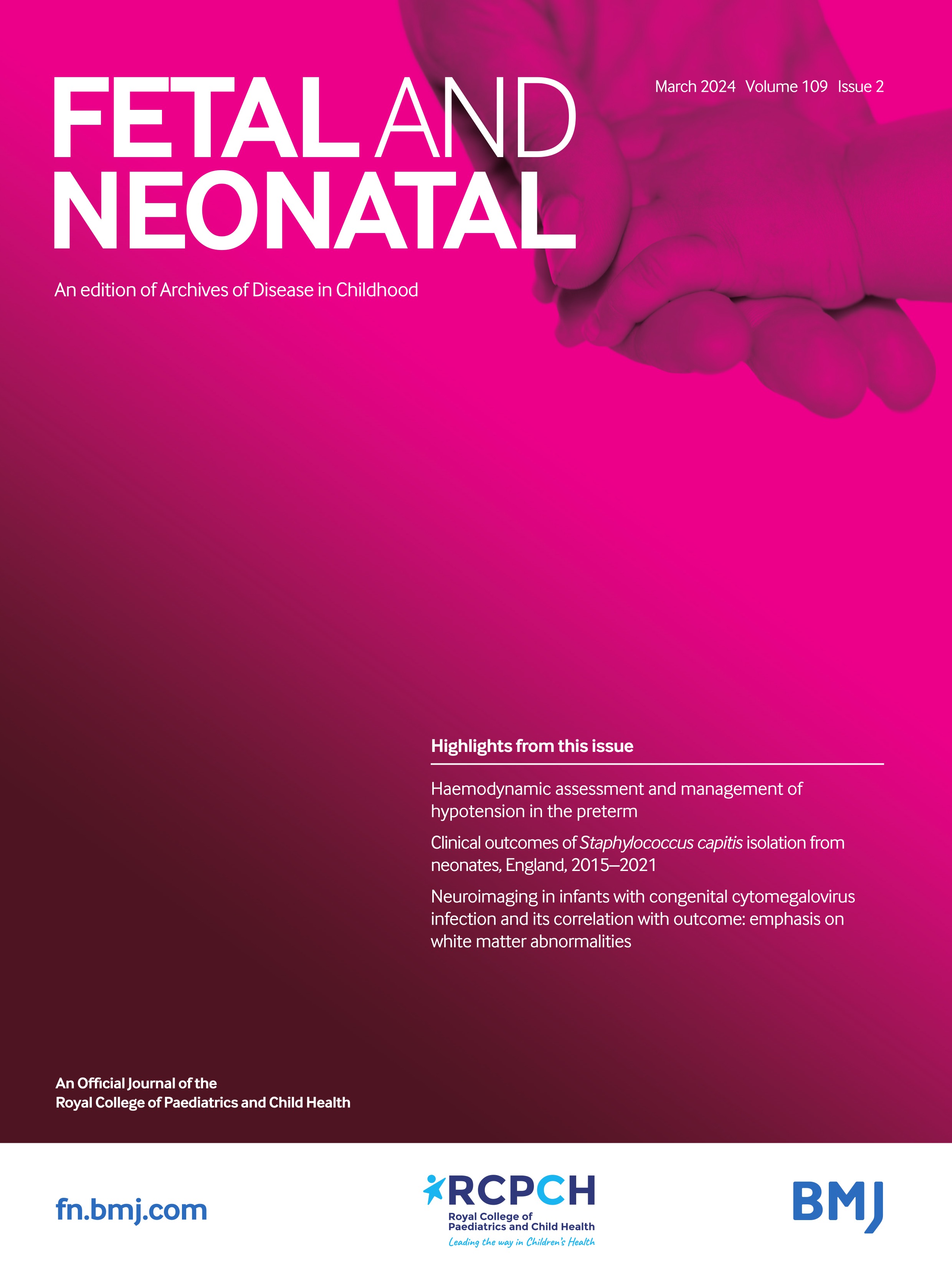 Identifying effect modifiers of systemic hydrocortisone treatment initiated 7-14 days after birth in ventilated very preterm infants on long-term outcome: secondary analysis of a randomised controlled trial