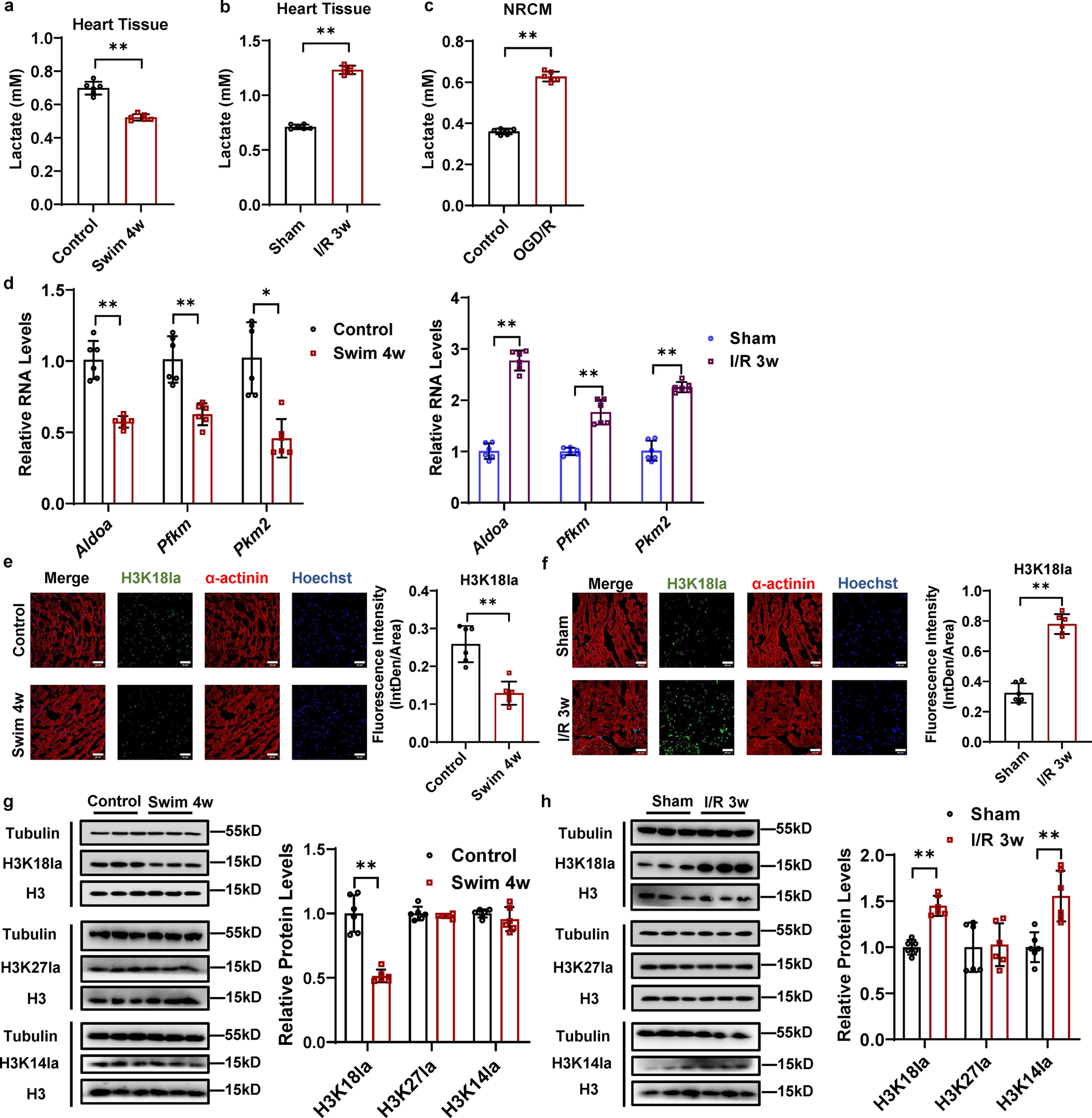 Exercise training decreases lactylation and prevents myocardial ischemia–reperfusion injury by inhibiting YTHDF2