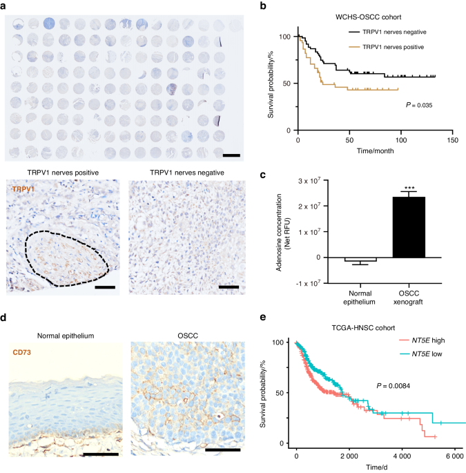 Nociceptive adenosine A2A receptor on trigeminal nerves orchestrates CGRP release to regulate the progression of oral squamous cell carcinoma