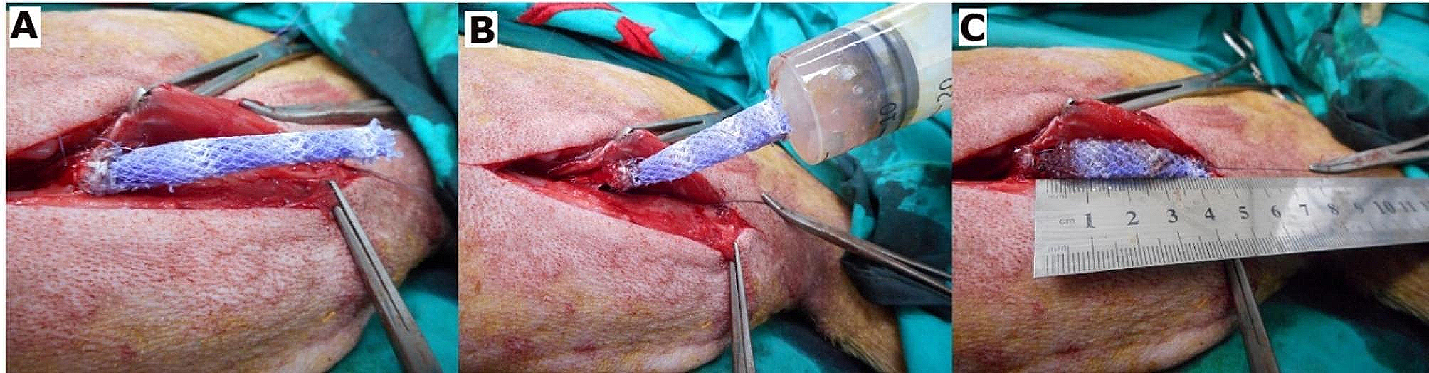 Efficacy of using adipose-derived stem cells and PRP on regeneration of 40 -mm long sciatic nerve defect bridged by polyglycolic-polypropylene mesh in canine model