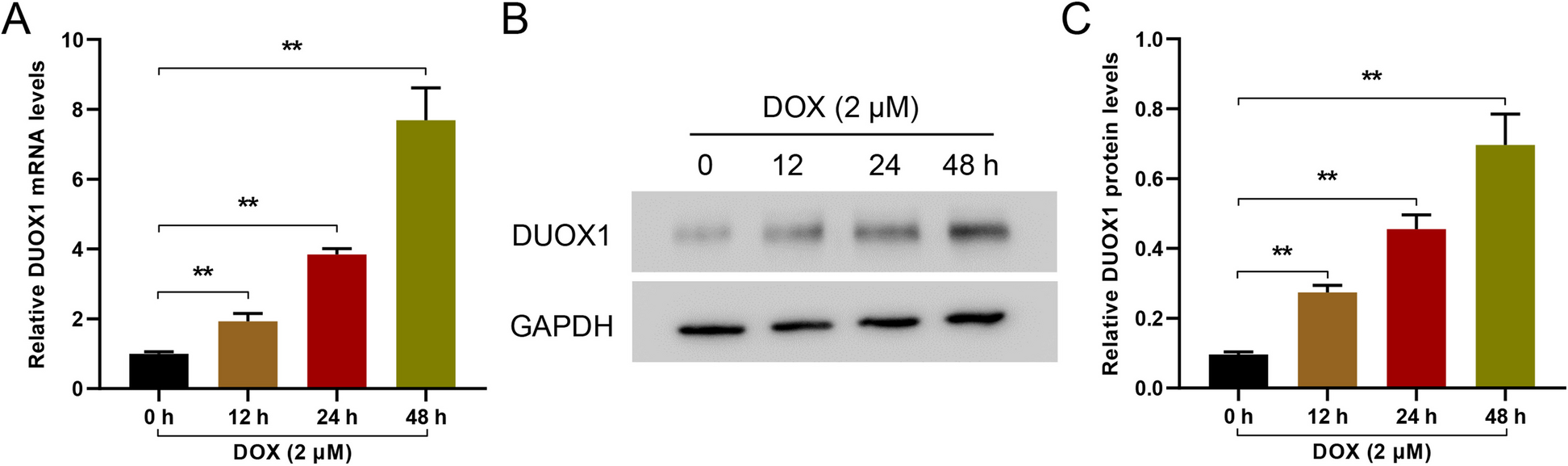 Upregulated dual oxidase 1-induced oxidative stress and caspase-1-dependent pyroptosis reflect the etiologies of heart failure