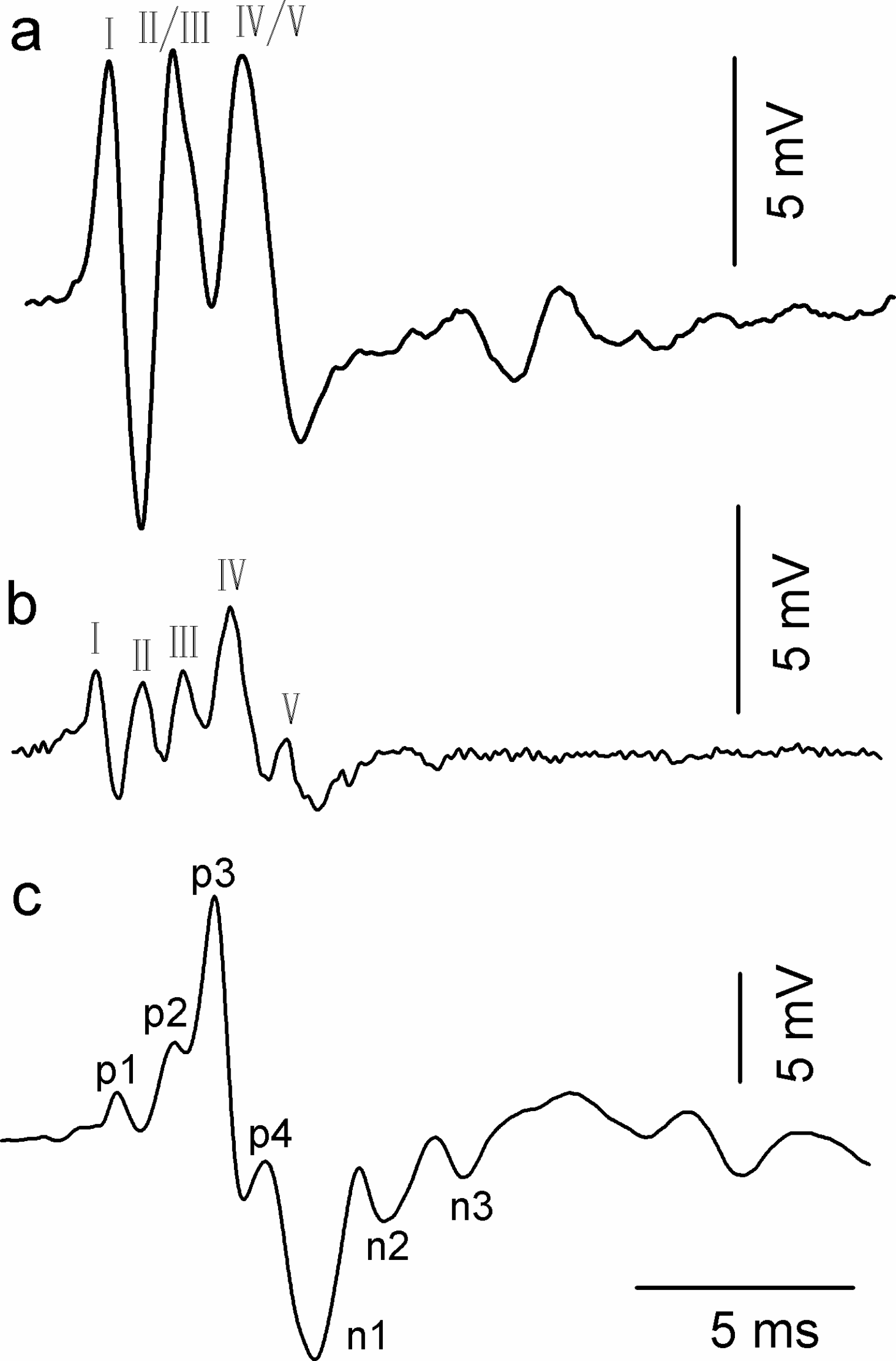 Vocalization-induced middle ear muscle reflex and auditory fovea do not contribute to the unimpaired auditory sensitivity after intense noise exposure in the CF-FM bat, Hipposideros pratti