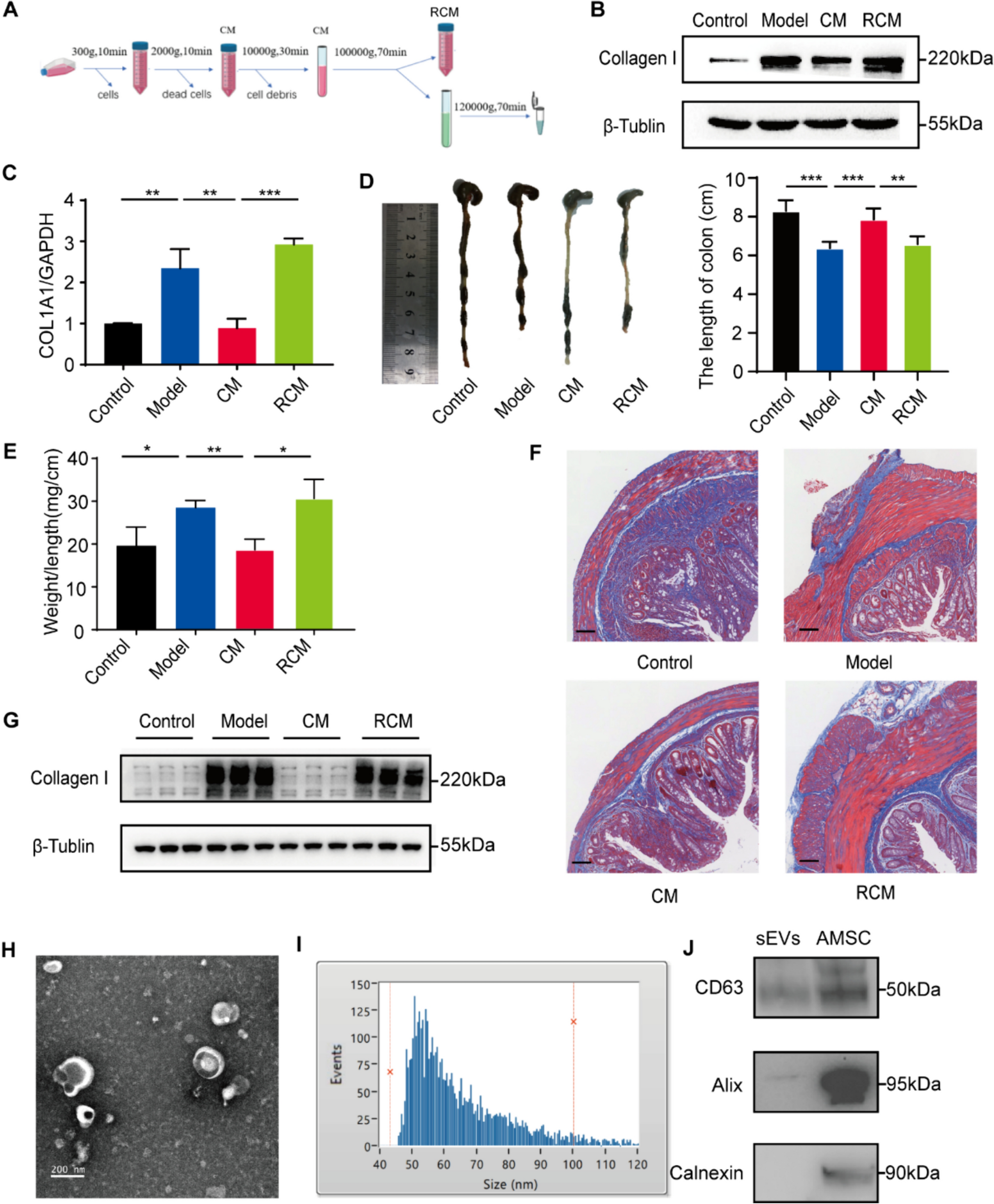 Small extracellular vesicles derived from adipose mesenchymal stem cells alleviate intestinal fibrosis by inhibiting the FAK/Akt signaling pathway via MFGE8