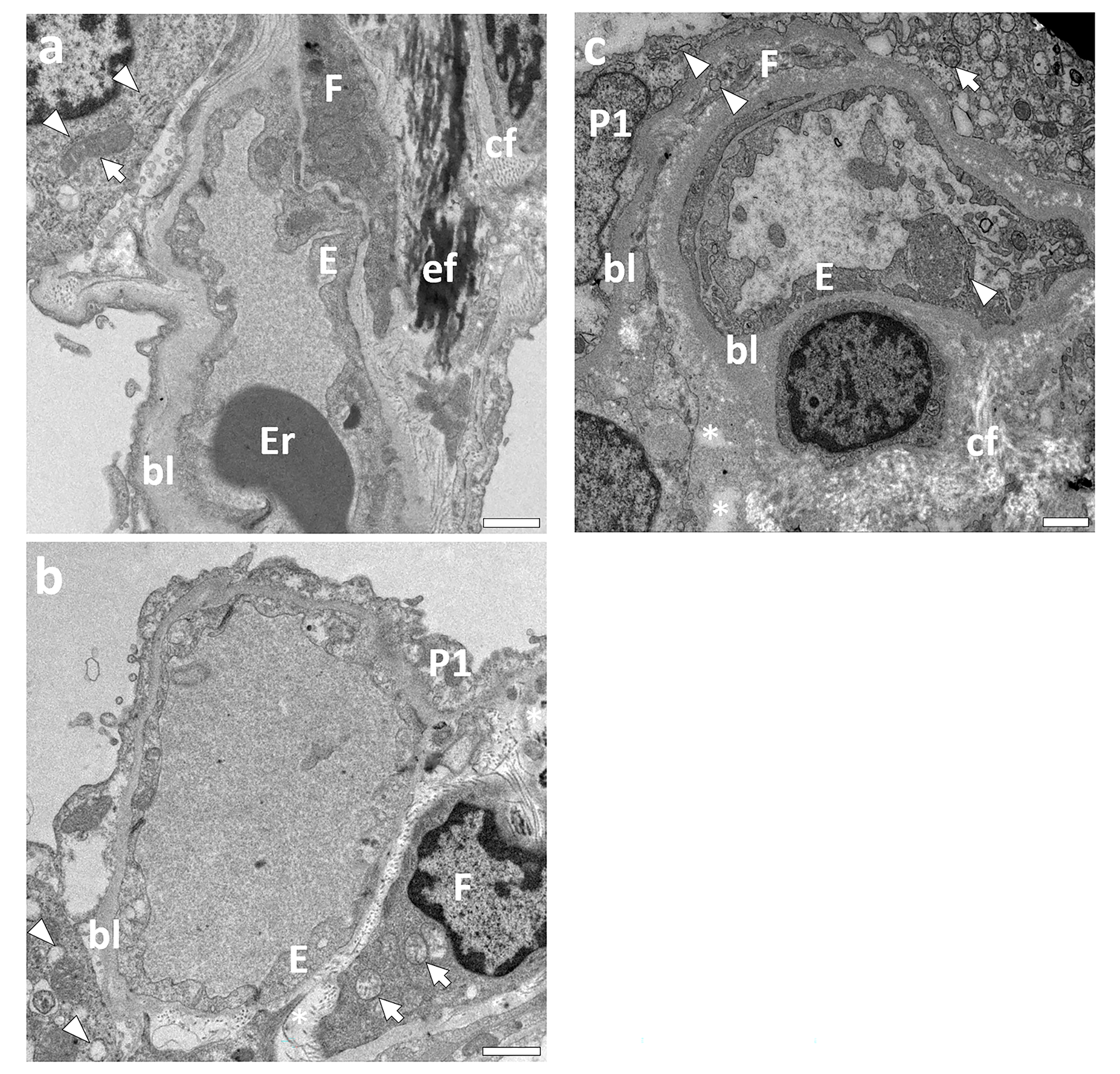 Transmission electron microscopy of transbronchial lung cryobiopsy samples in a cohort of fibrotic interstitial lung disease patients – feasibility and implications of endothelial alterations