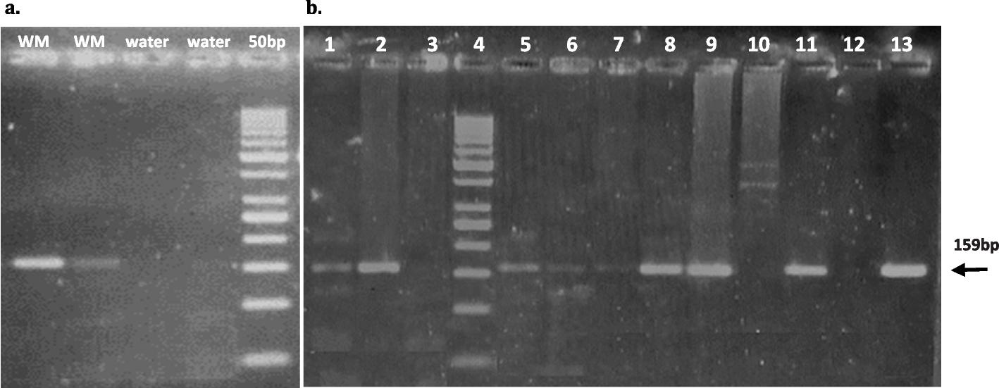 Utility of clinical, laboratory, and lymph node MYD88 L265P mutation in risk assessment of diffuse large B-cell lymphoma patients