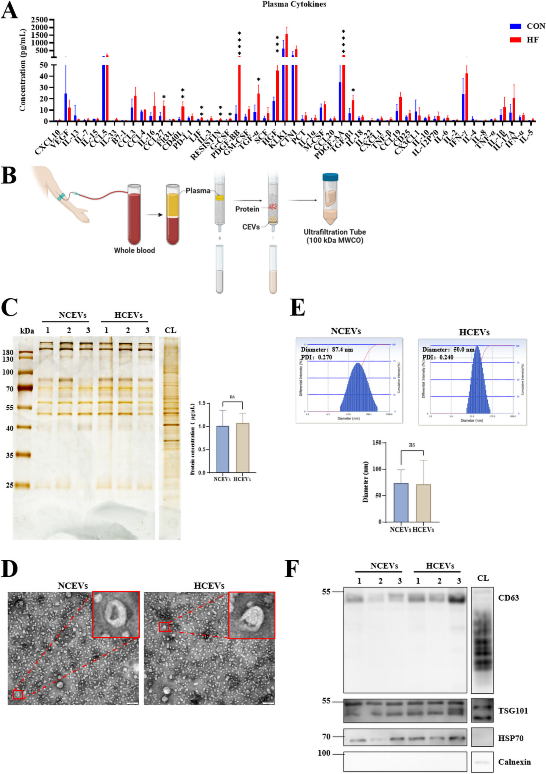 Circulating Extracellular Vesicles from Heart Failure Patients Inhibit Human Cardiomyocyte Activities