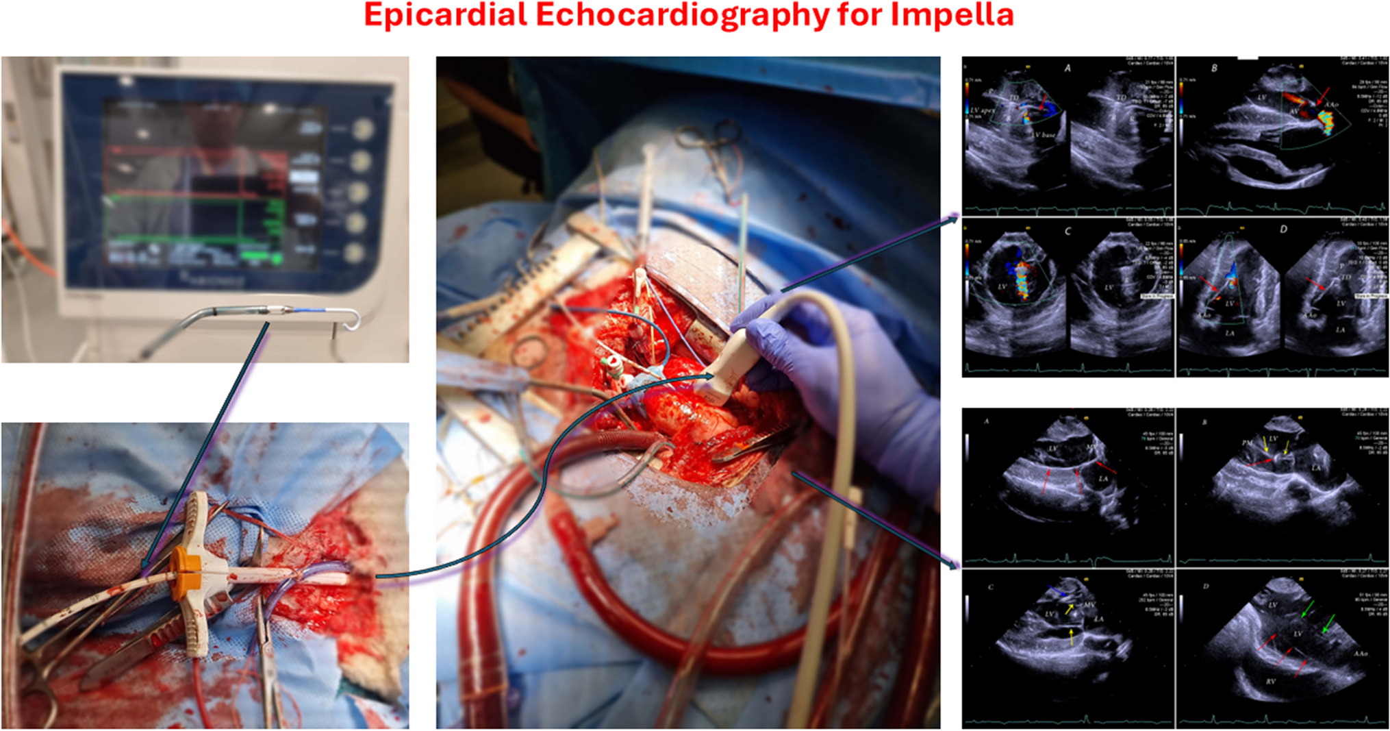 Pearls and Pitfalls of Epicardial Echocardiography for Implantation of Impella CP Devices in Ovine Models