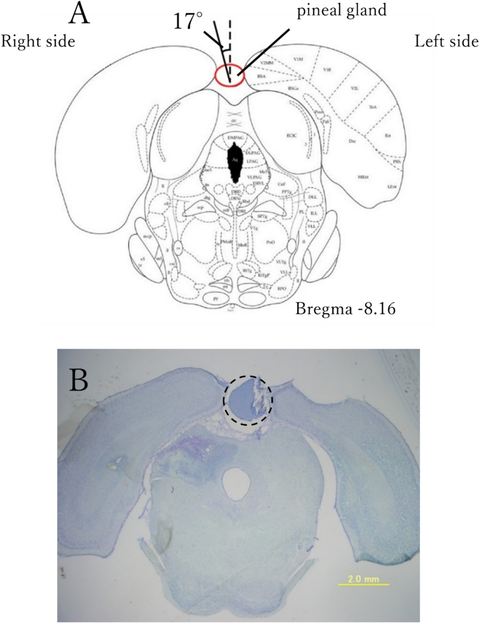 Changes of melatonin secretion in the neuropathic pain induced sleep disorder model rat