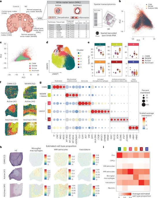 Spatially resolved gene signatures of white matter lesion progression in multiple sclerosis