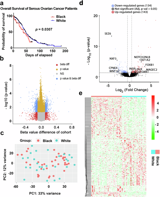 Comparative transcriptomic, epigenomic and immunological analyses identify drivers of disparity in high-grade serous ovarian cancer