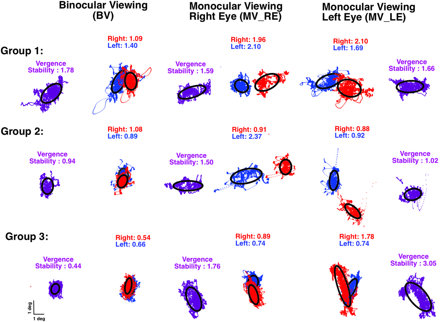 Assessing inter-ocular fixational eye movements throughout the lifespan