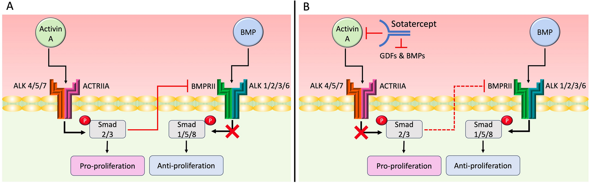Pulmonary Arterial Hypertension and TGF-β Superfamily Signaling: Focus on Sotatercept