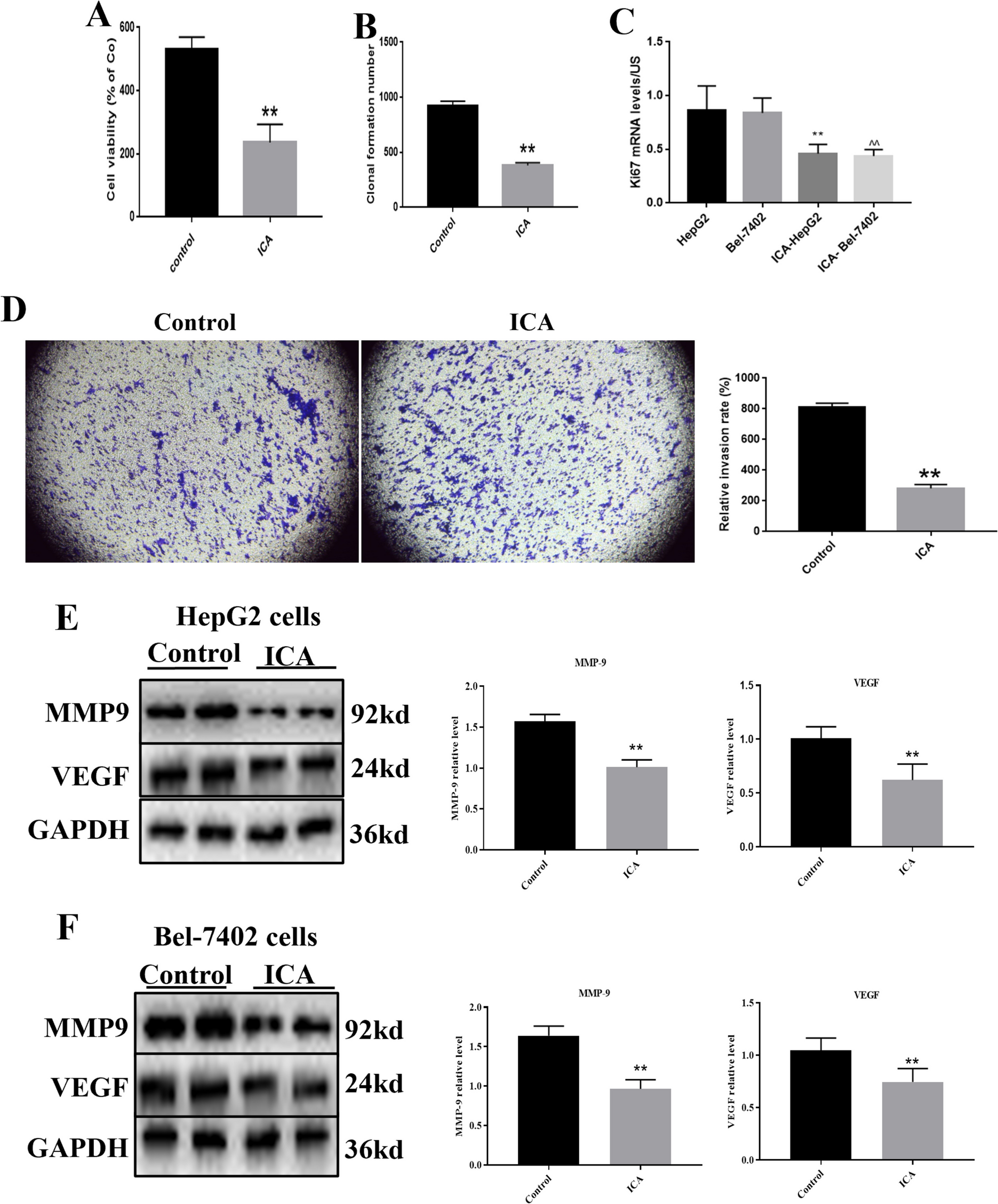 Icariin mediates autophagy and apoptosis of hepatocellular carcinoma cells induced by the β-catenin signaling pathway through lncRNA LOXL1-AS1