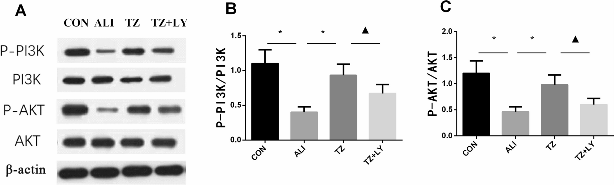 Tocilizumab alleviated lipopolysaccharide-induced acute lung injury by improving PI3K/AKT pathway