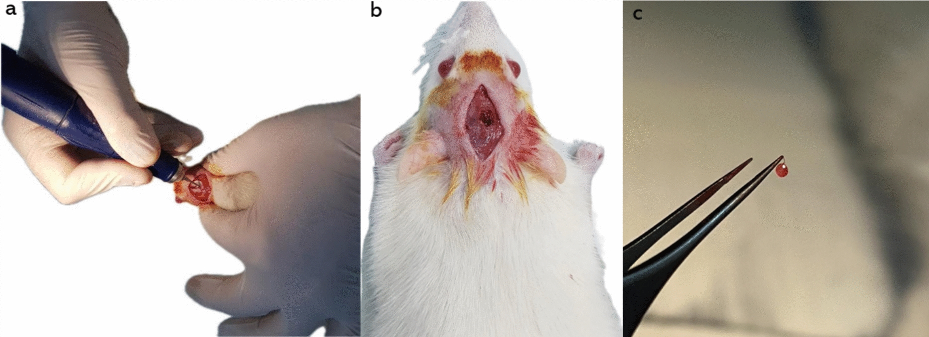 Investigation of the effects of pinealectomy on acetylcholinesterase enzyme activity and oxidative stress in rat brain