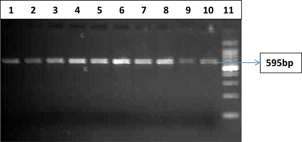 The Implication of ENSA, K-ATP Channel Encoding Gene Variations in Type 1 Diabetes in Children of South Indian Population