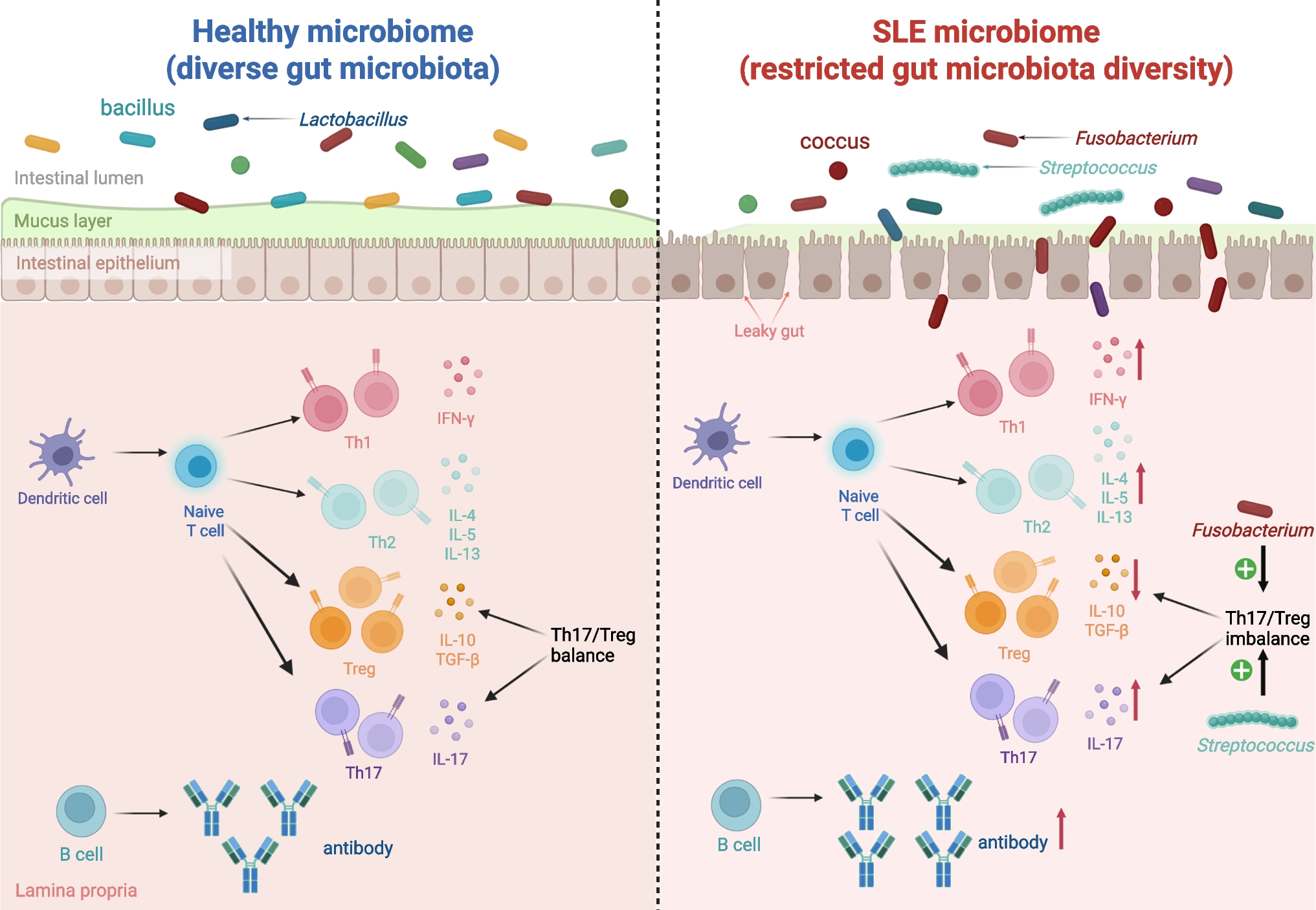 Exploring Gut Microbiota in Systemic Lupus Erythematosus: Insights and Biomarker Discovery Potential