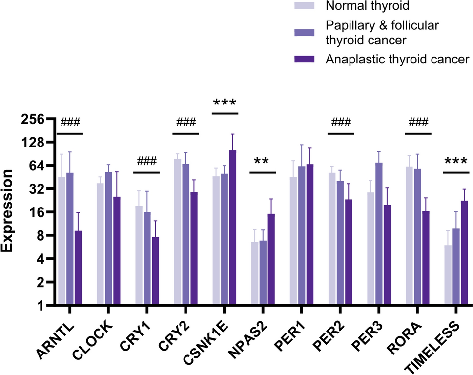 Identifying  as a therapeutic target in thyroid cancer among the core circadian clock genes