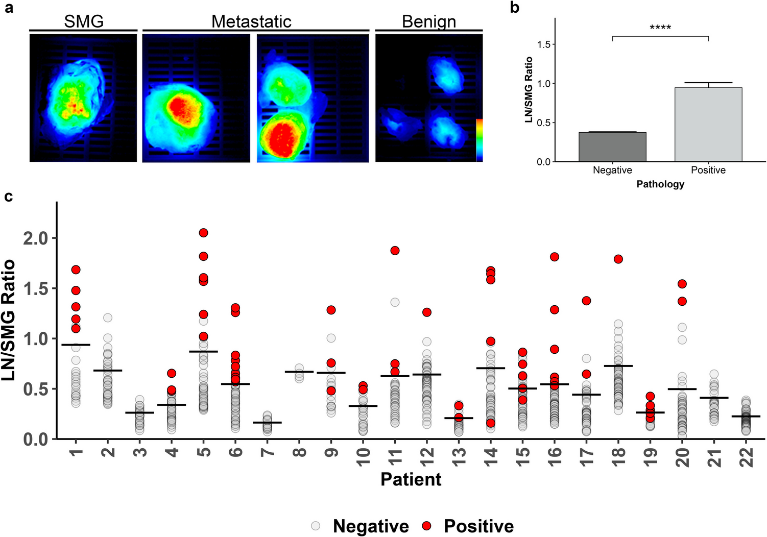 Background Tissue with Native Target Expression Can Determine Presence of Nodal Metastasis in Head and Neck Squamous Cell Carcinoma Patients Infused with Targeted Fluorescent Tracers