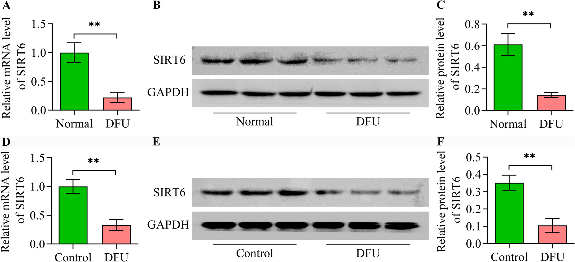 SIRT6 Overexpression Enhances Diabetic Foot Ulcer Healing via Nrf2 Pathway Activation