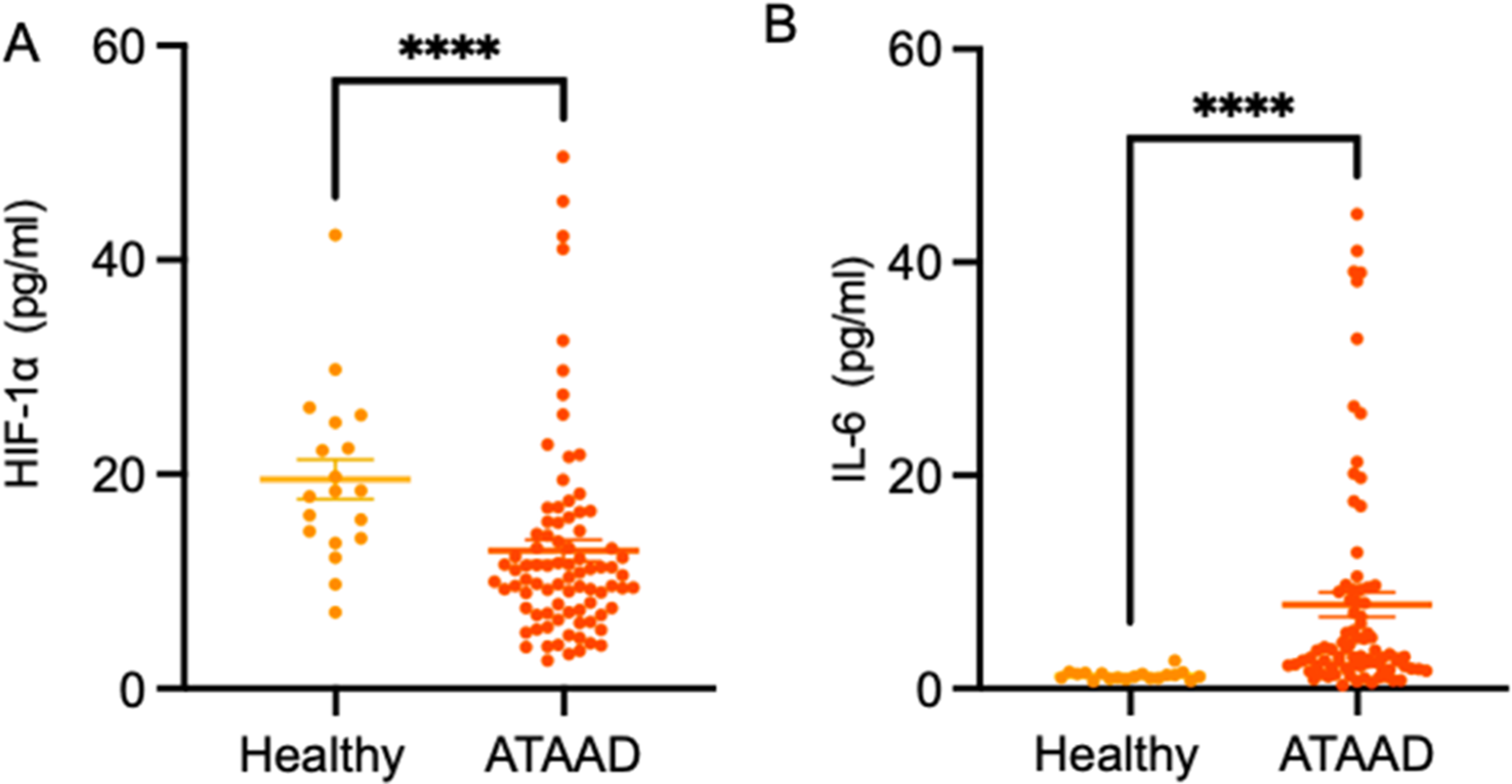 Analysis of serum levels of HIF-1α and IL-6 in patients with acute stanford type a aortic dissection