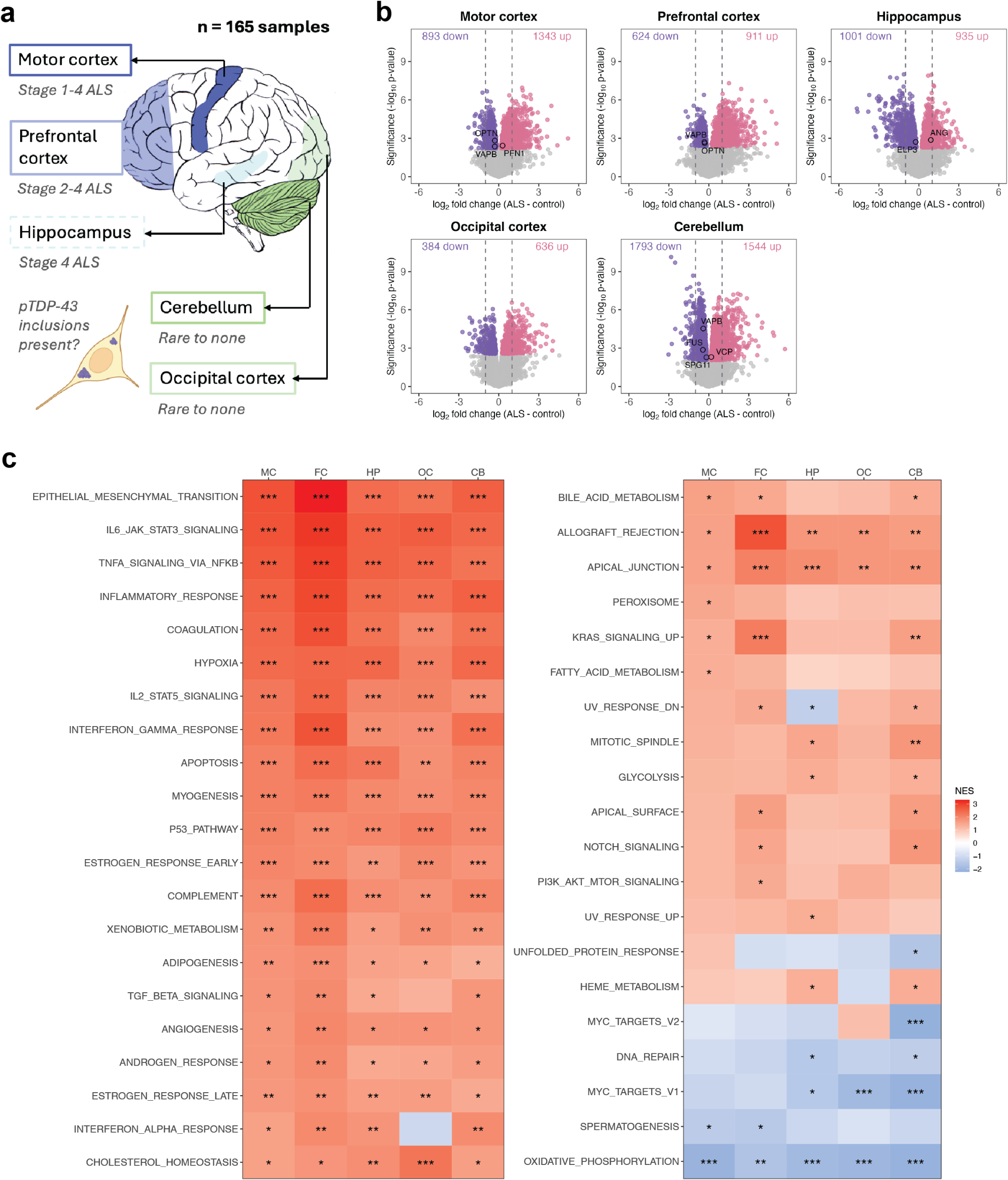 Multi-region brain transcriptomic analysis of amyotrophic lateral sclerosis reveals widespread RNA alterations and substantial cerebellum involvement