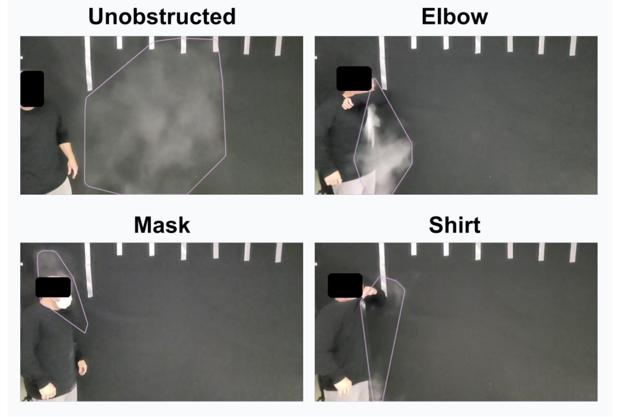 A pilot study of coughing into the shirt to disrupt respiratory pathogen transmission