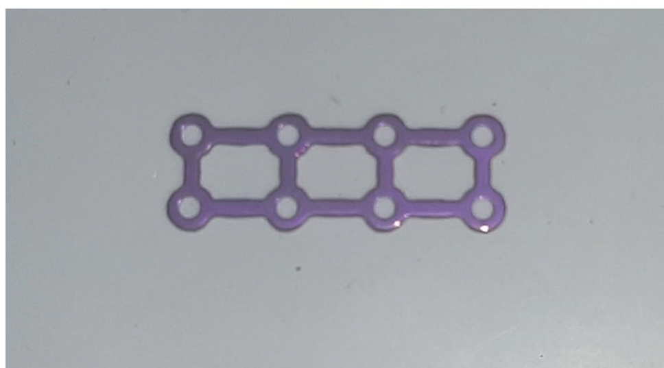 Efficacy of 3D Microplates in the Management of Anterior Mandibular Fractures: A Prospective Study