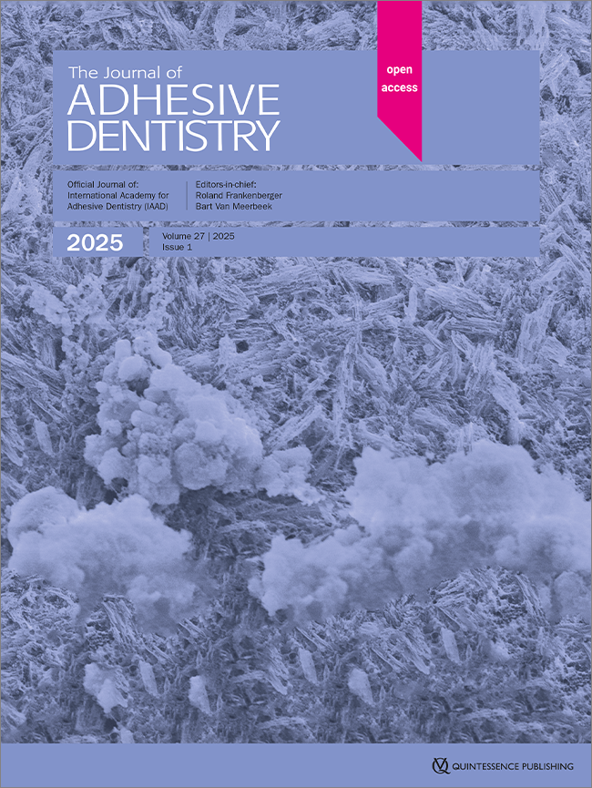 Push-out Bond Strength of Bulk-Fill Composites Used as Intracanal Anchorage Material