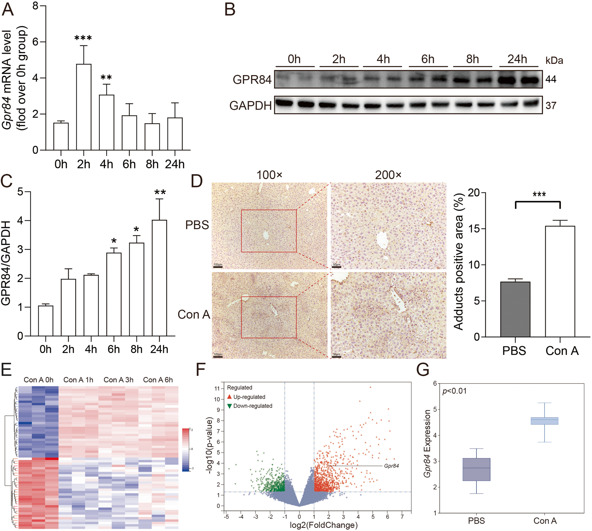 Targeting GPR84 to alleviate acute immune-mediated liver injury
