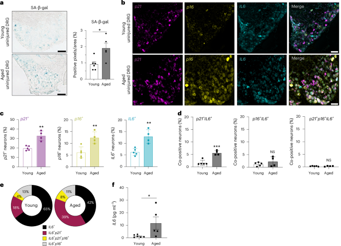Aging and injury drive neuronal senescence in the dorsal root ganglia