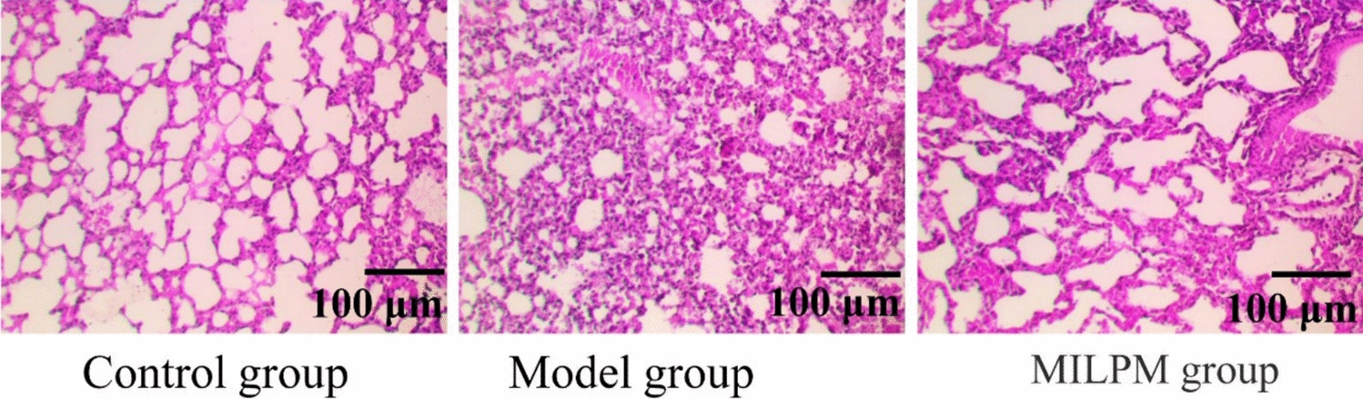 Multidimensional integrated lung protection measures attenuate pulmonary inflammation and improve lung function by inhibiting the NF-κB signaling pathway in elderly patients with lung dysfunction
