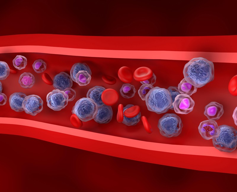 Using metformin to stall clonal hematopoiesis