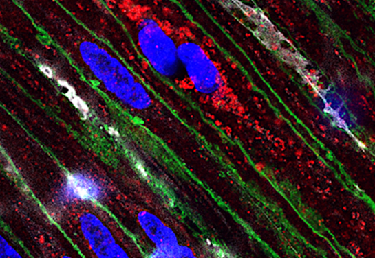 The surprising role of a key pressure-sensing protein in gut health