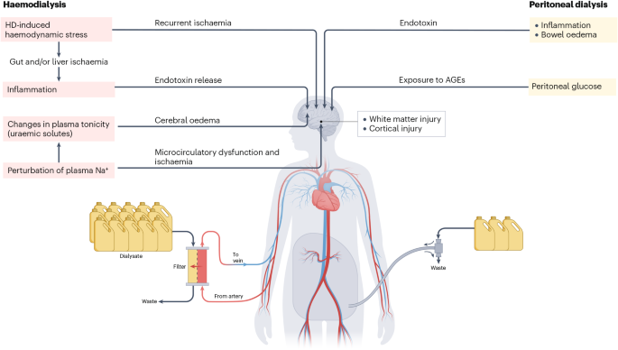 Dialysis and cognitive impairment