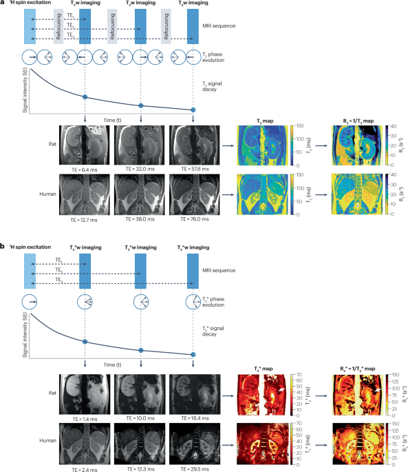 Magnetic resonance imaging of renal oxygenation