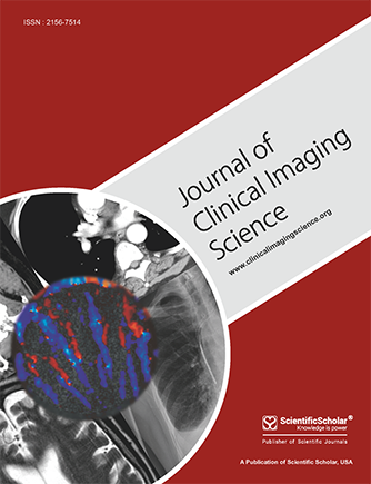 Ventriculoperitoneal shunt catheter migration to the pulmonary artery: A rare case report