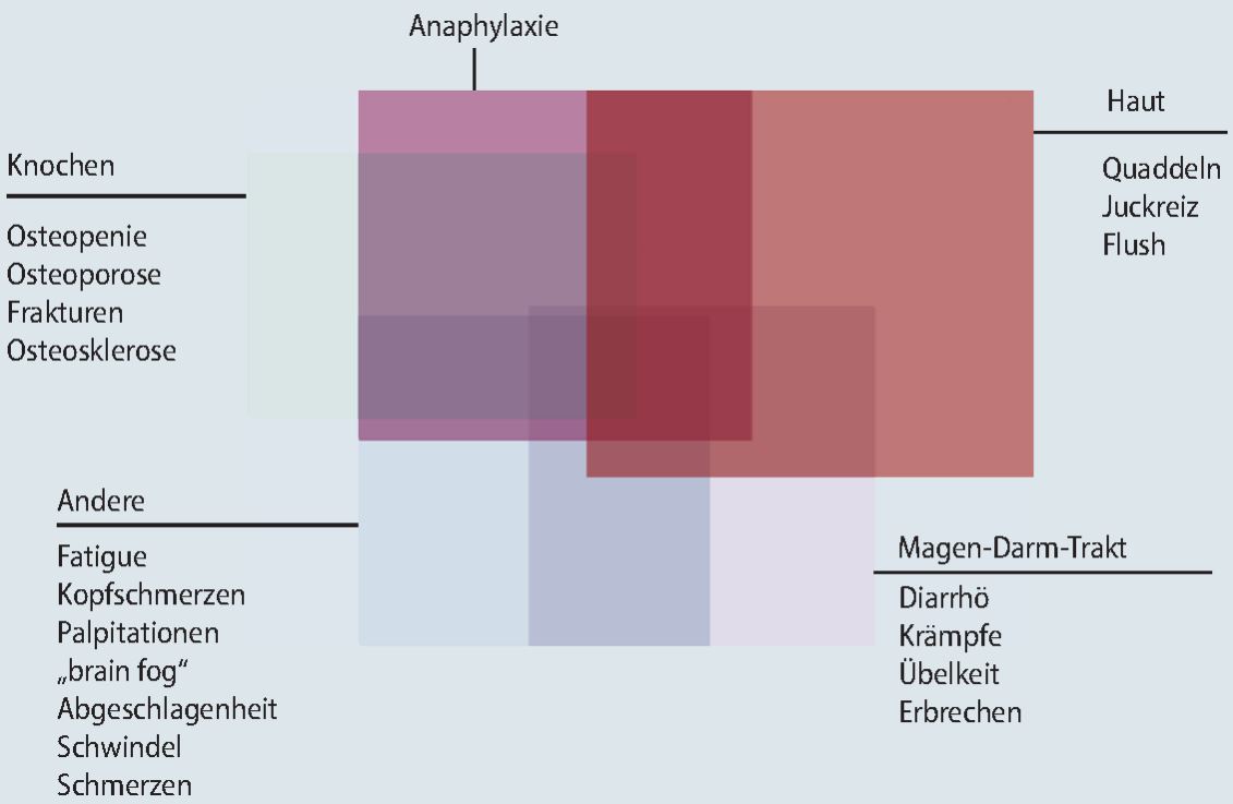 Mastozytose im Zeitalter der Präzisionsmedizin