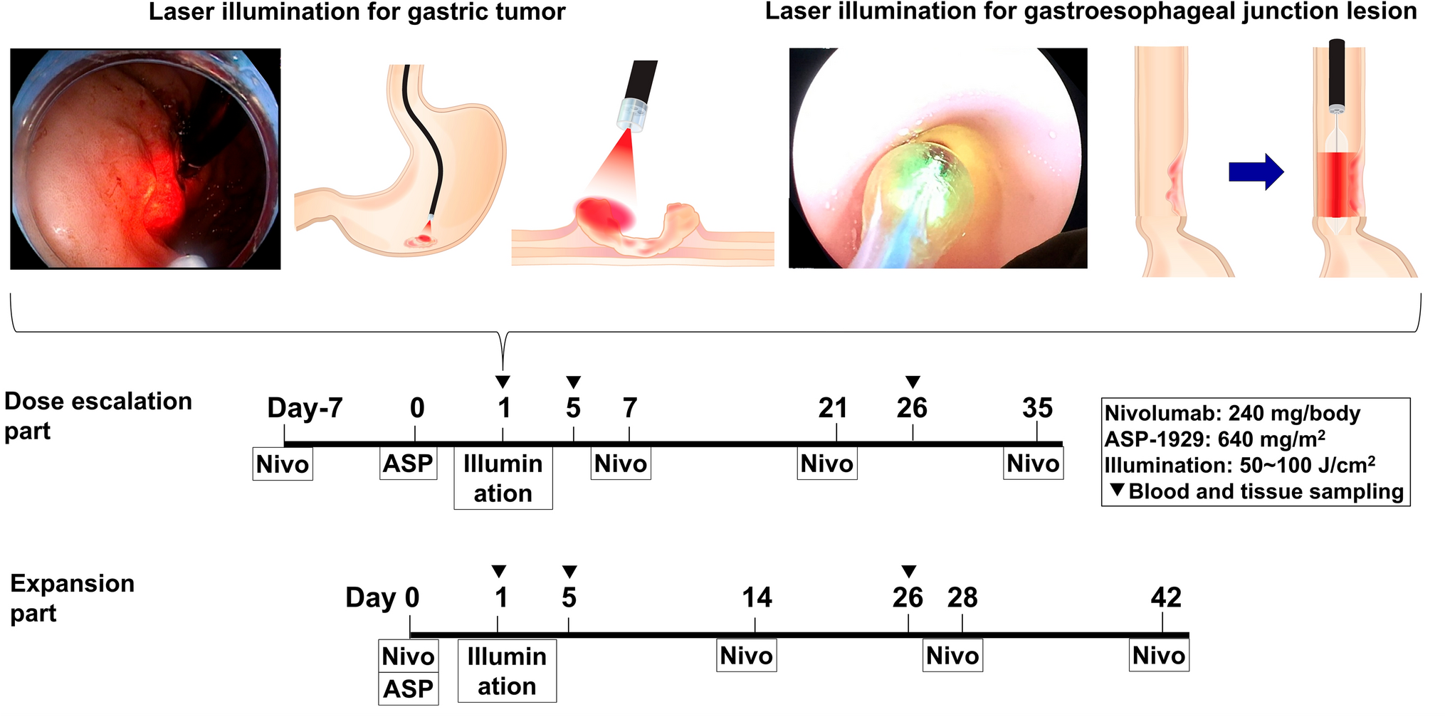 A phase Ib study of photoimmunotherapy with ASP-1929 in combination with nivolumab for advanced gastric cancer (GE-PIT, EPOC1901)