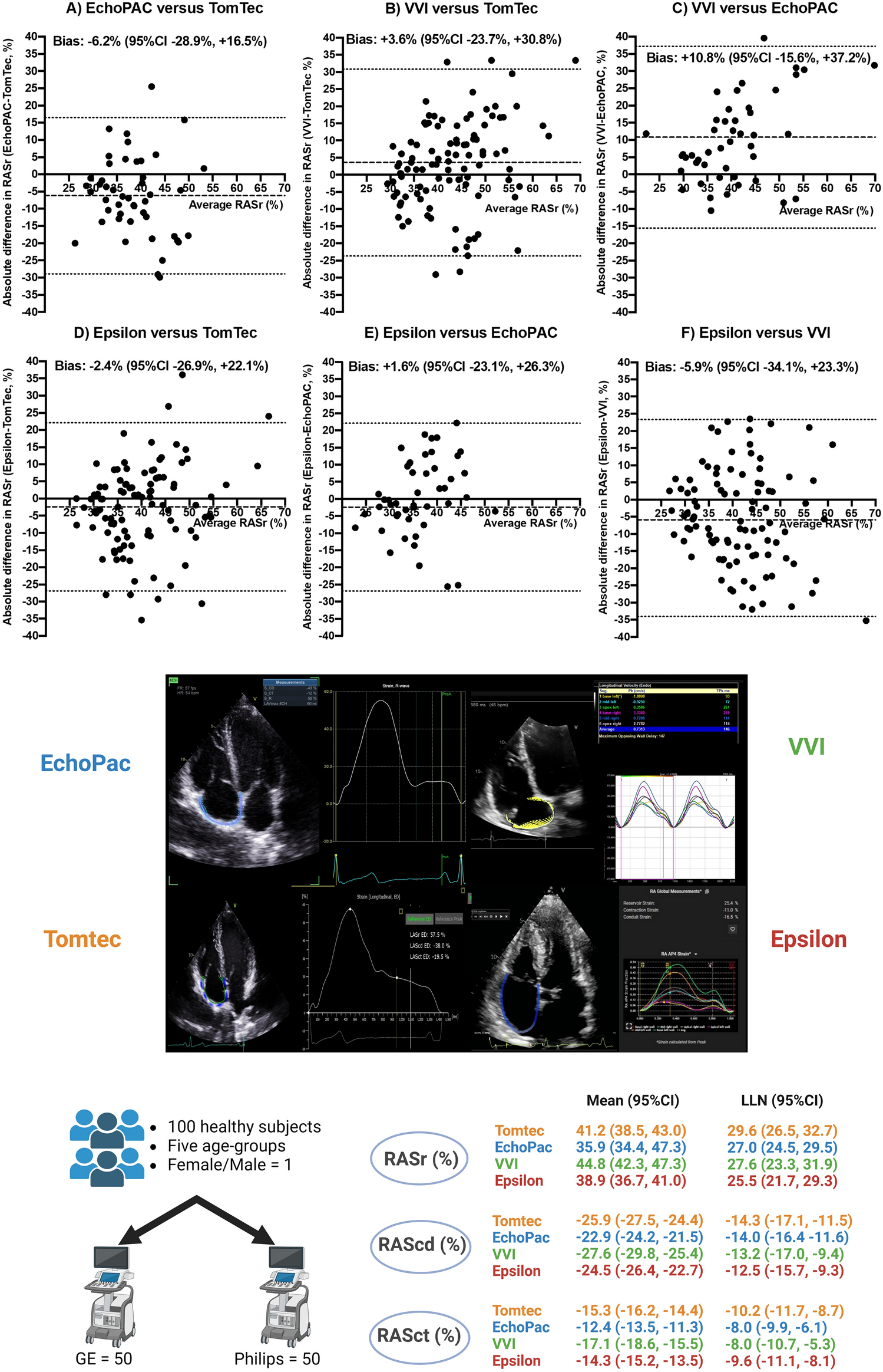 Normal ranges of right atrial strain by contemporary echocardiography software: a prospective comparative cohort study