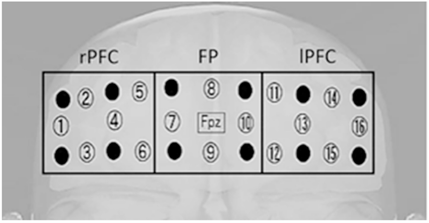 Brain activation during vocal motor imagery: a pilot functional near-infrared spectroscopy (fNIRS) study