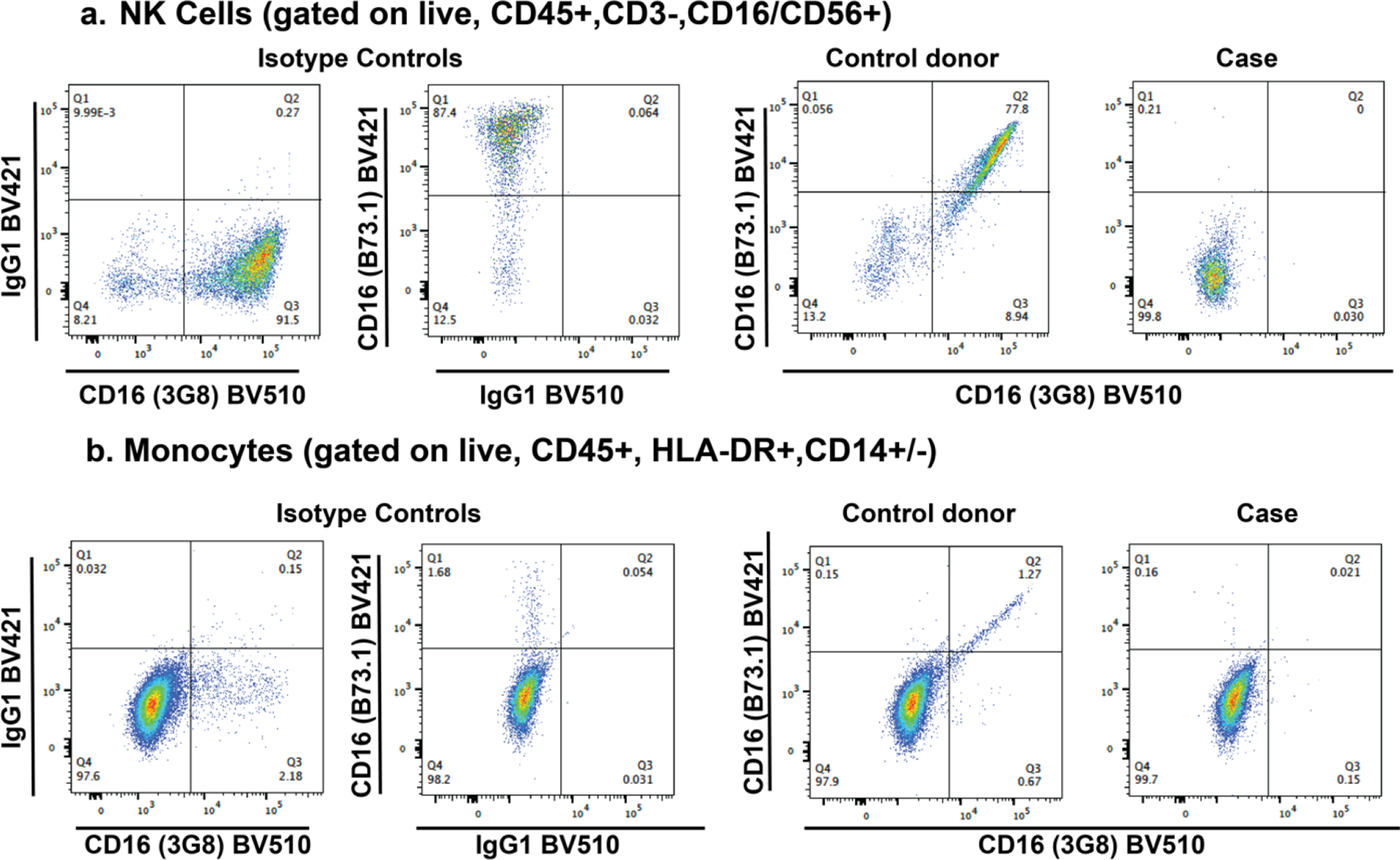 Complete CD16A Deficiency and Defective NK Cell Function in a Man Living with HIV