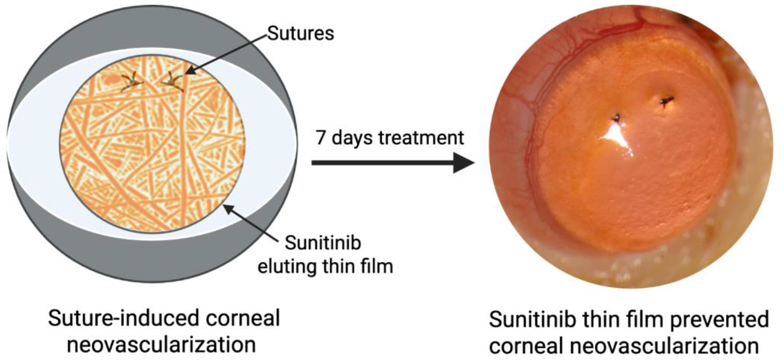 Sunitinib-eluting thin films for Inhibition of corneal neovascularization