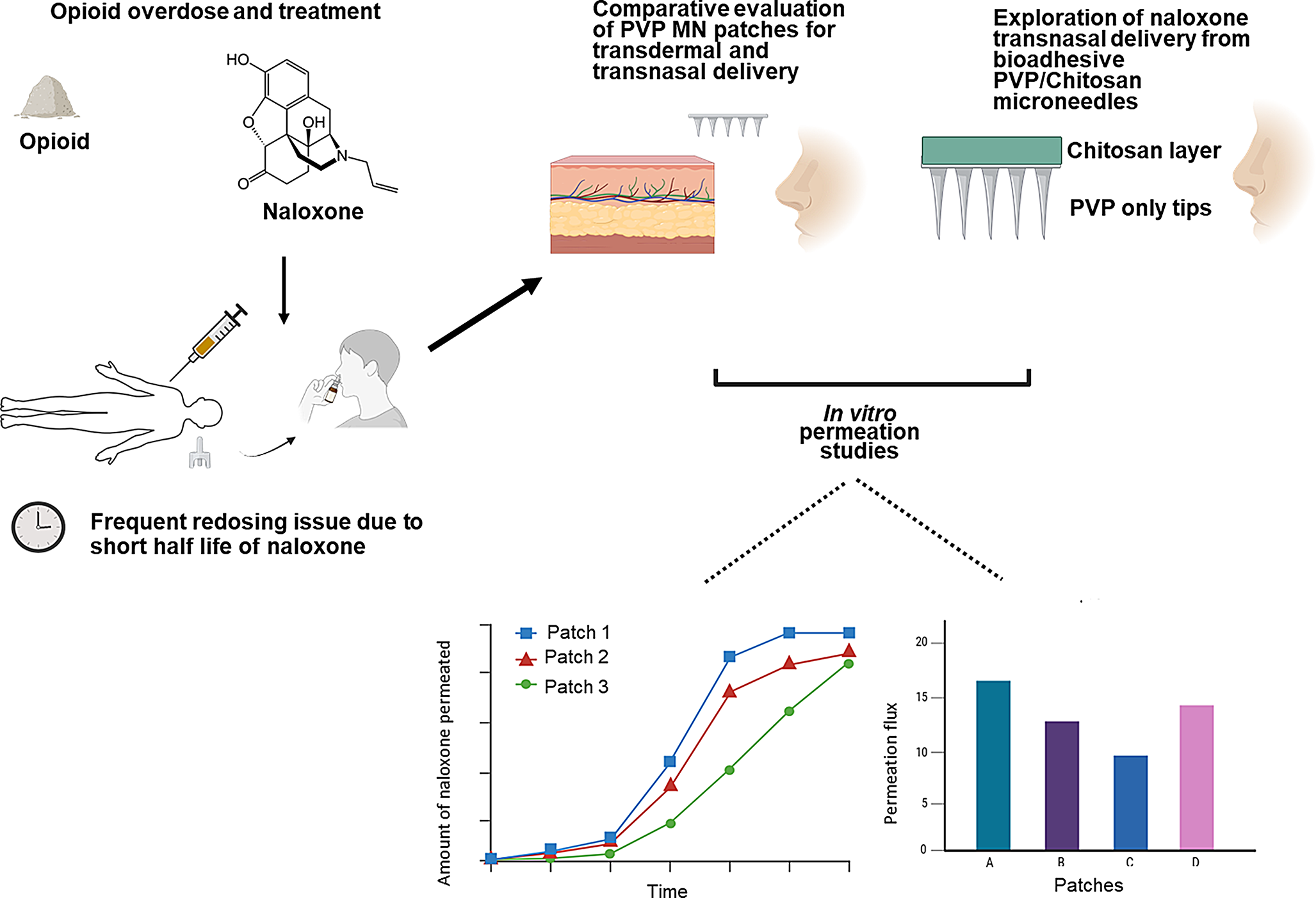 Microneedle patch-based transnasal delivery of naloxone
