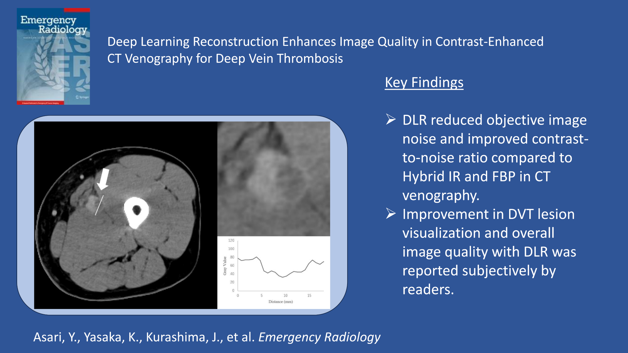Deep learning reconstruction enhances image quality in contrast-enhanced CT venography for deep vein thrombosis