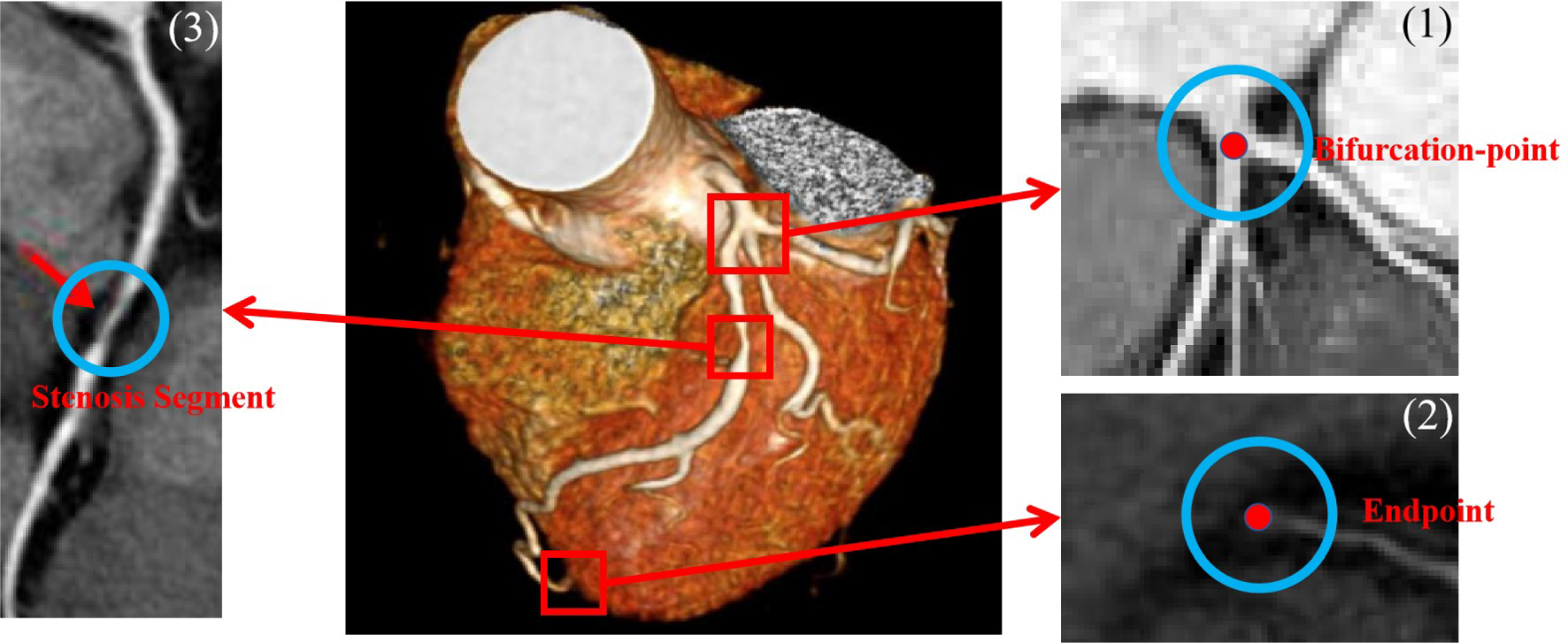 BEA-CACE: branch-endpoint-aware double-DQN for coronary artery centerline extraction in CT angiography images