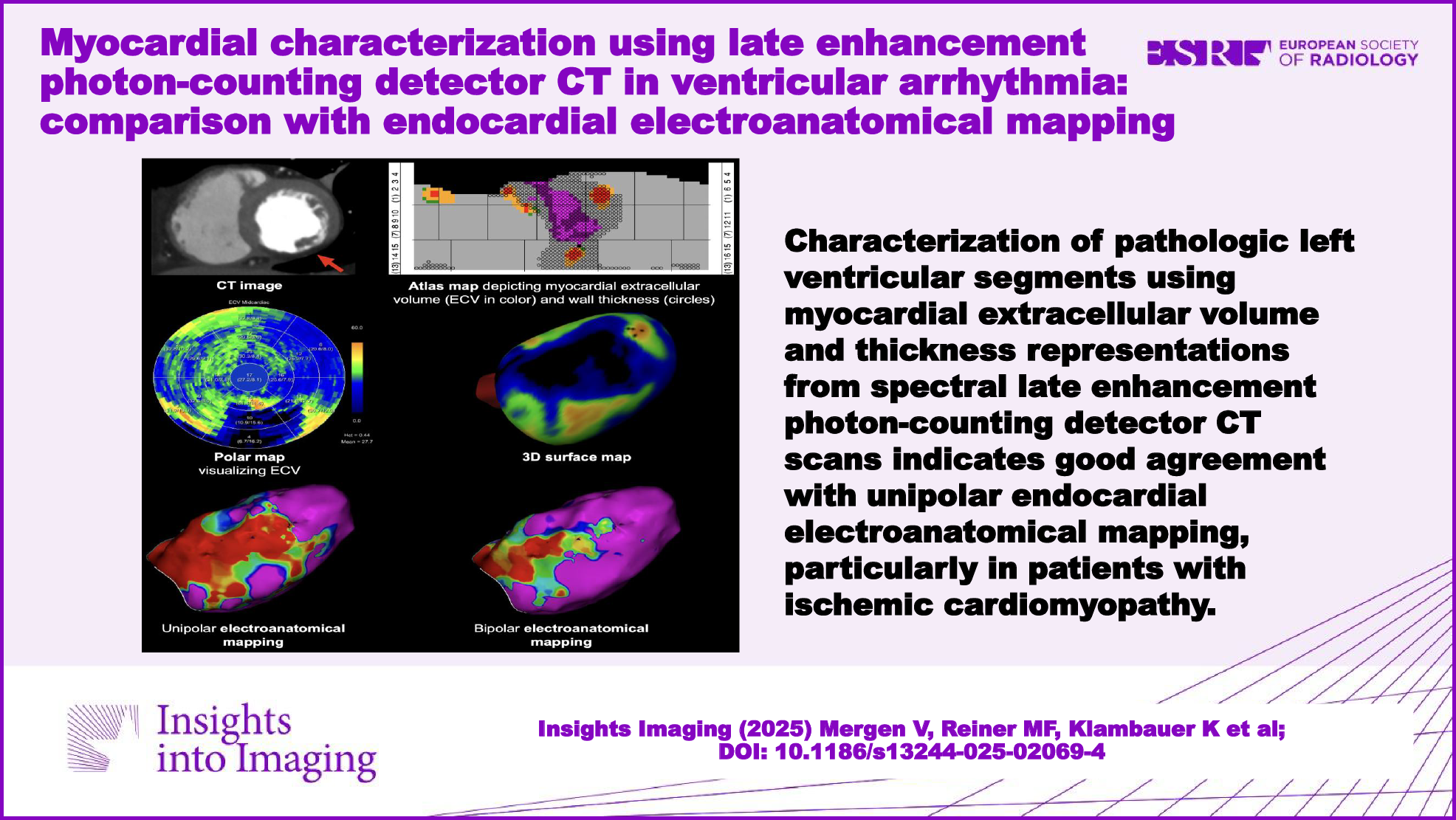 Myocardial characterization using late enhancement photon-counting detector CT in ventricular arrhythmia: comparison with electroanatomical mapping