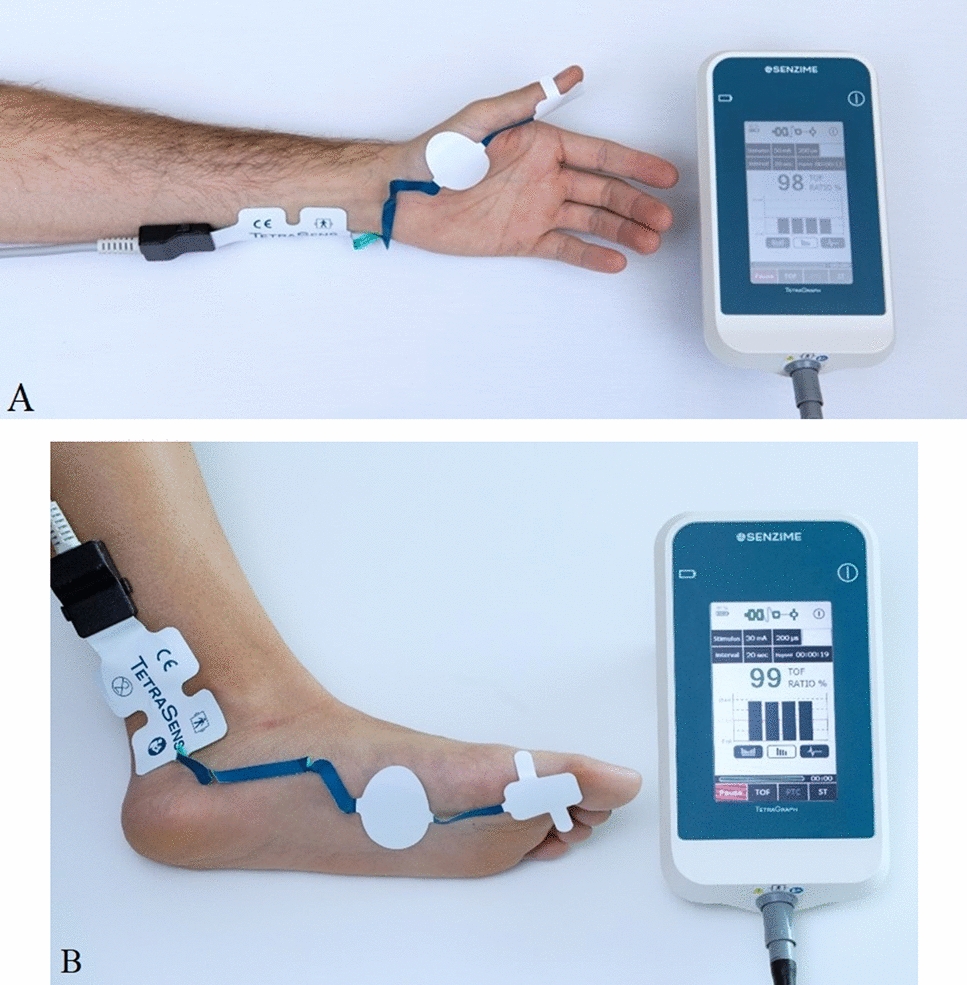 Comparison of adductor pollicis and flexor hallucis brevis muscle electromyographic responses: a prospective cohort study